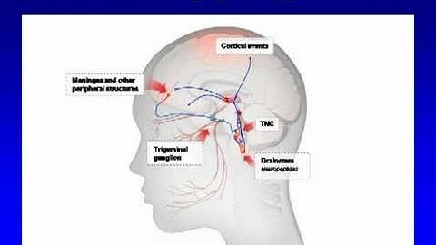 Grand Rounds:  Chronic Migraine Pt 3