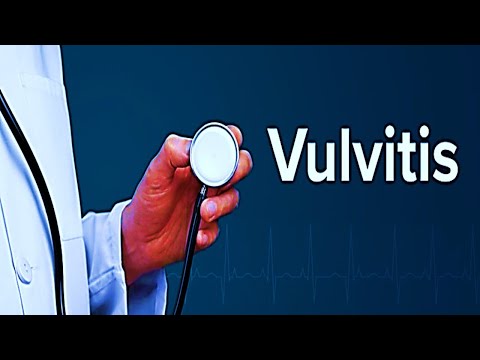 Vulvitis | FULL EXPLANATION IN HINDI BY N.G MEDICALS