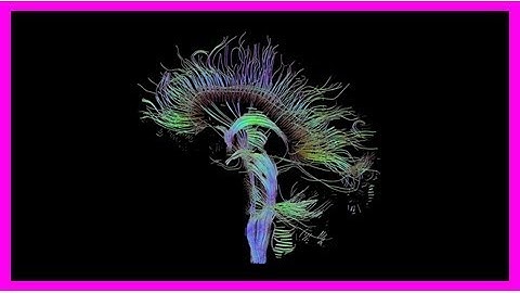 Europe’s human brain project needs urgent reforms, panel says