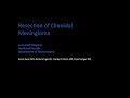 Resection of Clinoidal Meningioma