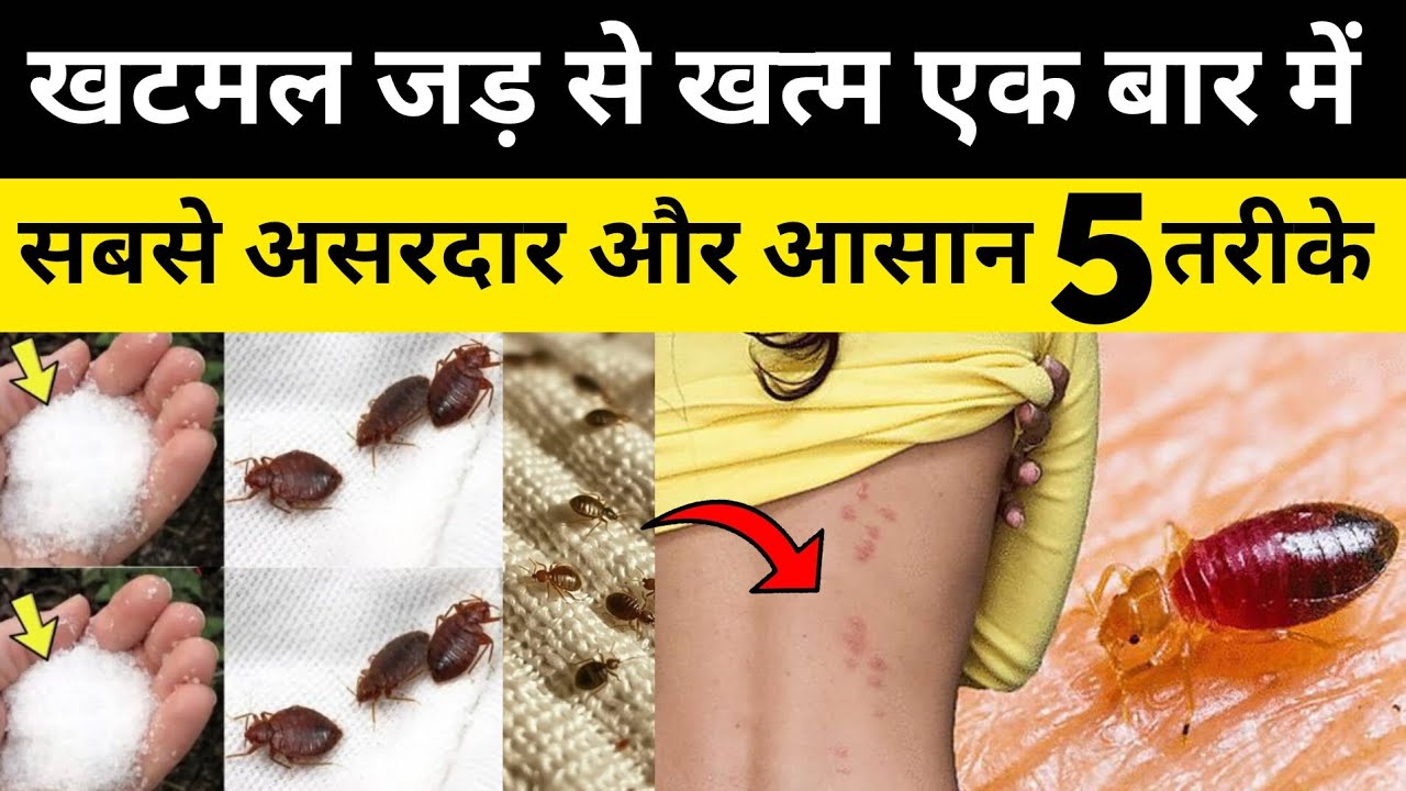 khatmal se chutkara kaise paye | How to get rid of bedbugs | खटमल मरने ...