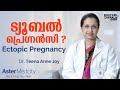 ട്യൂബൽ പ്രെഗ്നൻസി Or Ectopic Pregnancy | Malayalam Health Tips | Doctors in Kerala