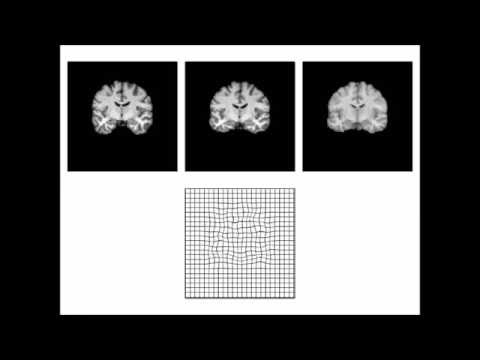 Diffusion Imaging in Python - DIPY
