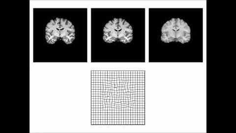 Nonlinear registration natively in DIPY