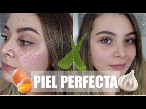 Monica A veces a veces incidente Remedios Naturales para una Piel Perfecta SIN ACNE! - Maqui015 ♥ - YouTube