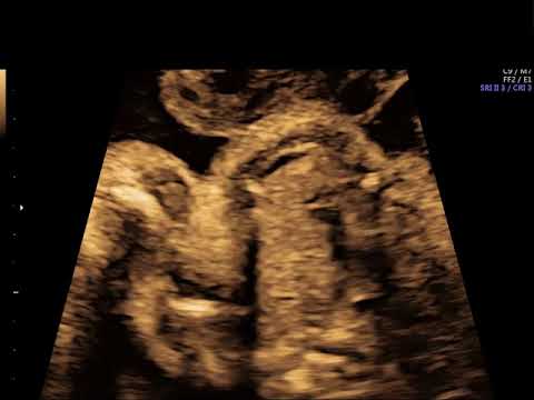 Case Challenge #81 Video 1