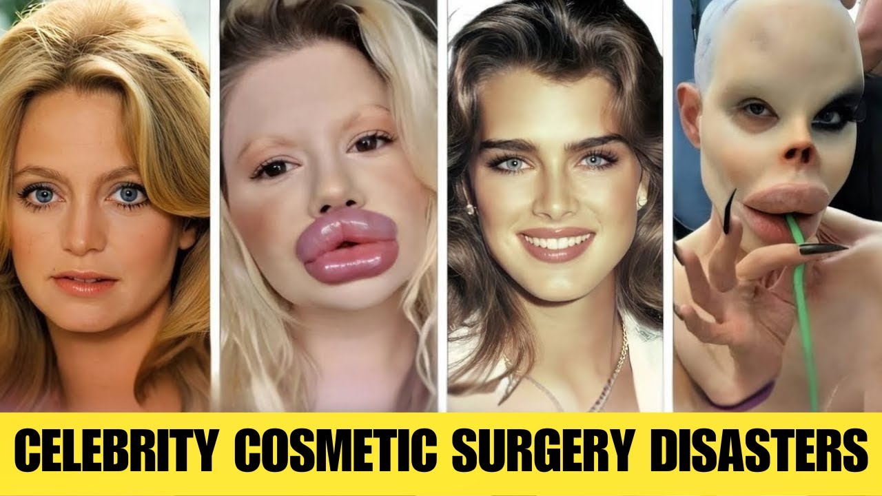 10 Celebrity Plastic Surgery Disasters You’d Never Recognize Them