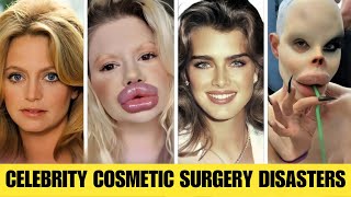 Famous 10 Celebrity Plastic Surgery Disasters – You’d Never Recognize Them Today | Then and Now 2025 Wealth
