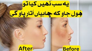 Short time secret of freckles removal| Remove  freckles ,dark spots naturally in summer