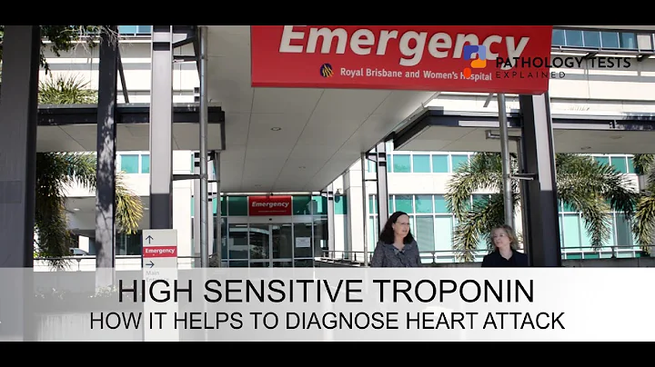 Troponin - the emergency department blood test and what it can show if you've had a heart attack