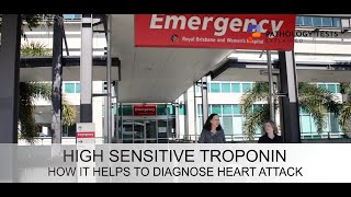 Troponin - the emergency department blood test and what it can show if you've had a heart attack