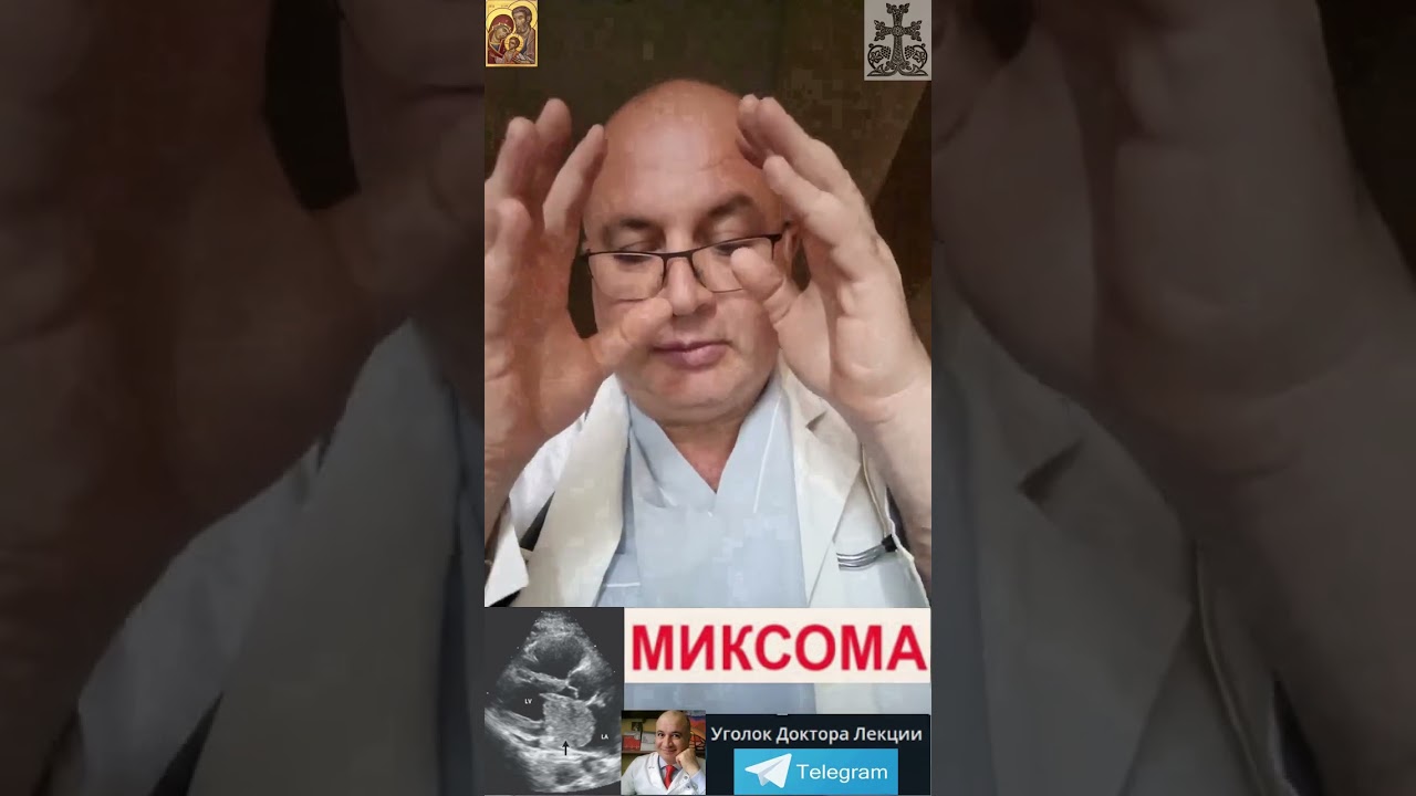 Мискома сердца - это не просто опухоль на стенке сердца!