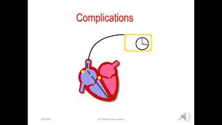 Dr. Manny Learnshop: Temporary cardiac pacing  Part 4