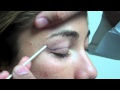 Dr. Jeffrey Epstein - Mark-Up for Upper Eyelid Blepharoplasty - Female Patient