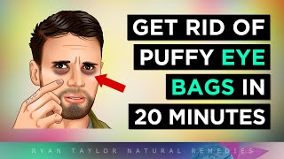 Get RID of Puffy Eyes Instantly (Natural Remedies) by Ryan Taylor (Natural Remedies) 9,056 views 4 weeks ago 11 minutes, 48 seconds