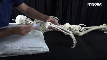 Ultrasound-Guided Elbow Joint Injection NYSORA (Freemedbooks.com)