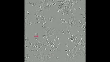 Red blood cell ingestion by hepatocytes – Video S1 [469990]