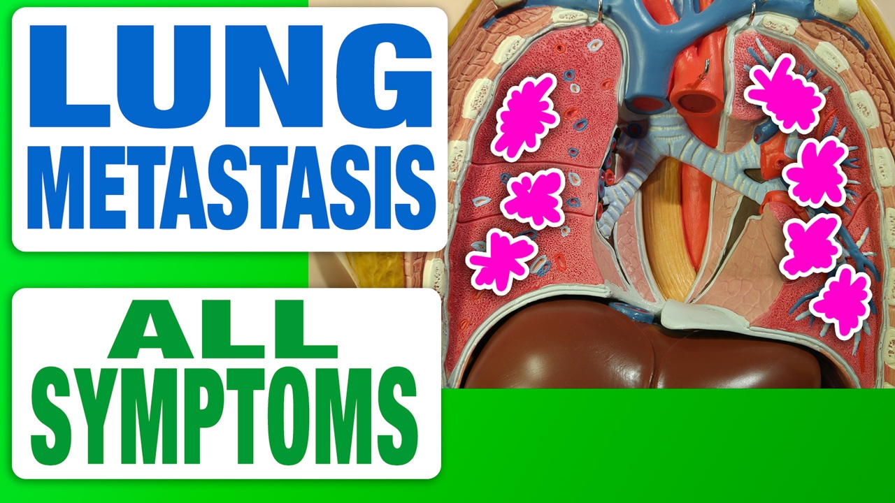 Lung Metastasis - All Symptoms