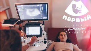 ВЛОГ:ПЕРВОЕ УЗИ-СКРИНИНГ!🤰🏼🧸