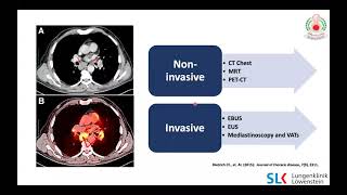 Thoracic Lymph Nodes | Part 2 | EBUS & EUS-B Introduction