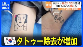 “痛みで逃げ出す人も” 韓国でタトゥー除去が増加　その背景に社会の変化 人口の4分の1がタトゥーを入れたとの推計｜TBS NEWS DIG