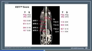 CURO Diagnostics ApS - VIDEO 4 Kissing Spine