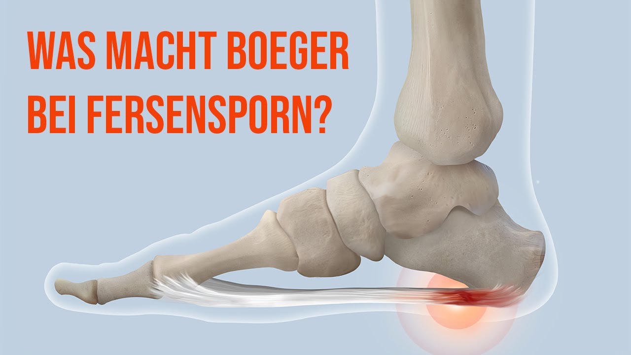 Fersensporn–ein Haltungsproblem/Boeger-Therapie
