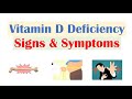 Vitamin D Deficiency (Part 2) | Clinical Features (ex. Osteoporosis), Diagnosis, Treatment