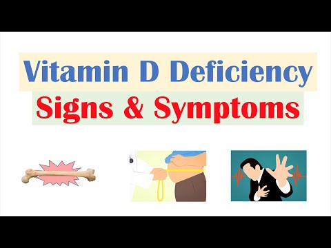 Vitamin D Deficiency Signs & Symptoms (ex. Fatigue), Diagnosis, Treatment