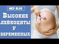 Высокие лейкоциты у беременных | Норма лейкоцитов у беременных | Основные причины высоких лейкоцитов