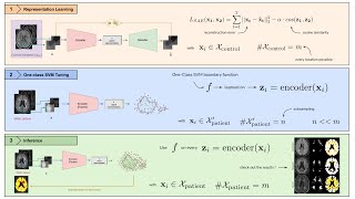 [P217] One-Class SVM on siamese neural network latent space for Unsupervised Anomaly Detection