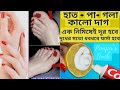 হাত -পা-গলা কালো দাগ এক নিমিষেই দূর হবে ✅ দুধের মতো ধবধবে ফর্সা হবে #skincare