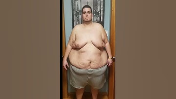 Weight Loss Transformation #SHORTS