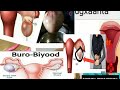 Waa Maxay Buro Biyood Ka Ovarain Cyst Pcos Caado Wareerka What Can Cause Ovarian Cysts Waa Maxay Buro Biyood Ka Ovarain Cyst Pcos Caado Wareerka What Can Cause Ovarian Cysts