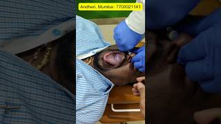 Treatment in Mumbai and Thane | CFR, BalloonTherapry #Chiropractic  #Chiropractor #Shortsfeed #Short
