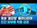 세계 최초 재생 '끝판왕' 플라나리아 인간 피부에 첫 적용