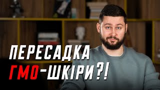 Вакцина від ВІЛ, пересадка гм-шкіри та інші наукові новини | Клятий раціоналіст