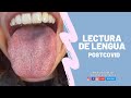 Lectura de lengua postcovid / Vitaminas, suplementos, salud intestinal