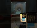 . "MRI Scan – From the Inside! #viral" #medicalimaging #viral #xray #radiology #petmri #mriscanner