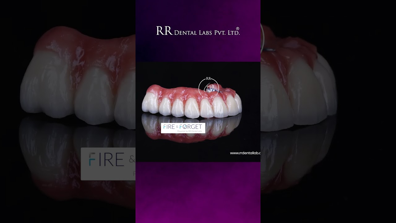 RR Dental Labs  Fire & Forget Implants & I-Dent Aligners  Trusted Digital Dental Lab in India