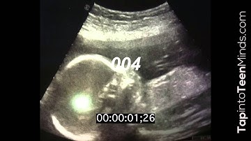 Baby Beats - 3 Act Math Task - Act 2 - Proportional Reasoning & Rates of Change