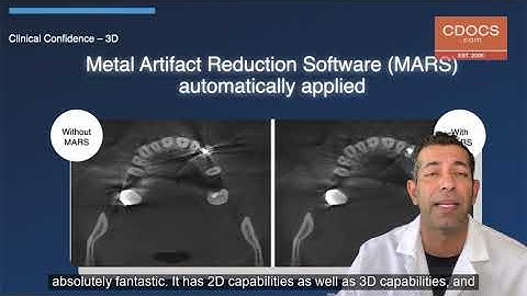 Tip of the Day: Axeos