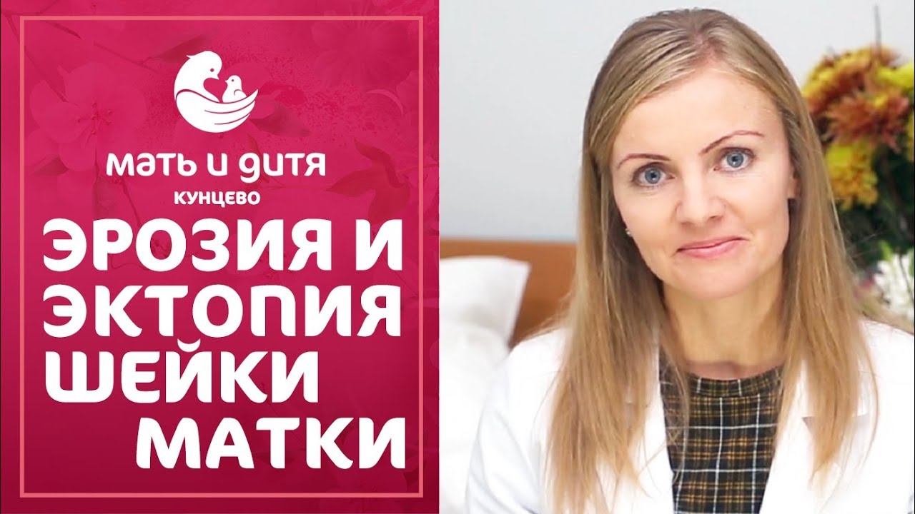 👩 Что такое эрозия и эктопия шейки матки, причины и лечение. Эрозия и ...