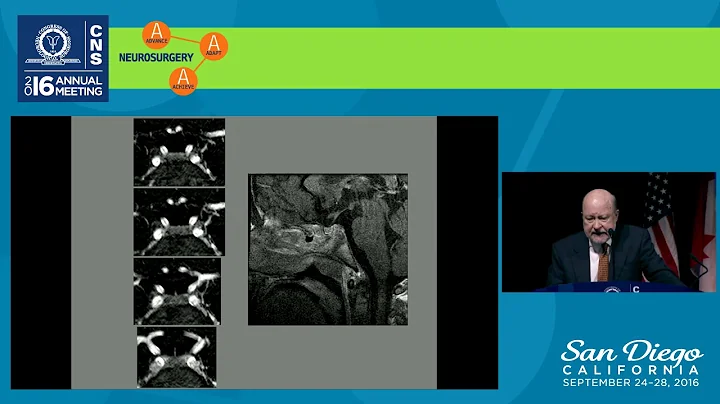 CNS 2016 Honored Guest Presentation: Cushing's Dis...
