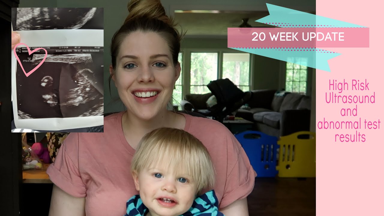 20 Weeks Pregnant and High Risk Ultrasound - YouTube