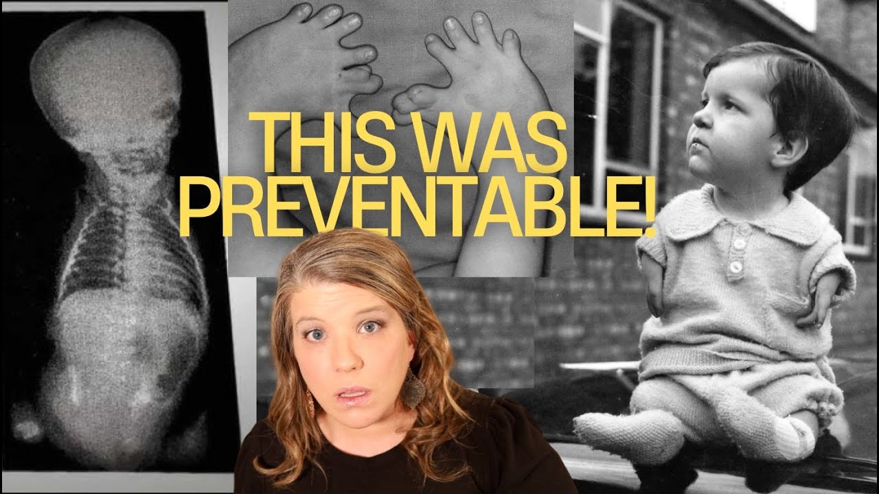 Poisoned Before Birth: The Horror Behind Thalidomide