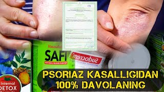 PSORIAZ KASALLIGIDAN 100% DAVOLANING / ПСОРИАЗ ЭНДИ МУАММО ЭМАС!!!