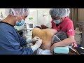 ジャケットを着た時にパツパツなので脂肪吸引をする！二の腕術中