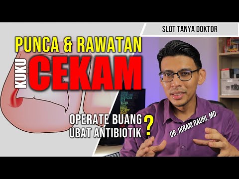 CARA BUANG KUKU CEKAM / CAGU. Cara Hilangkan Sakit dan Bau Busuk Kuku Cekam.