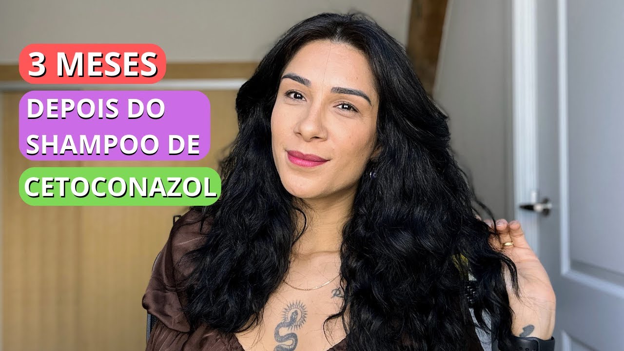 EFEITOS COLATERAIS DO SHAMPOO DE CETOCONAZOL | 3 MESES DEPOIS | Por ...